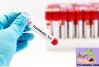 Cara Pengobatan Thalassemia